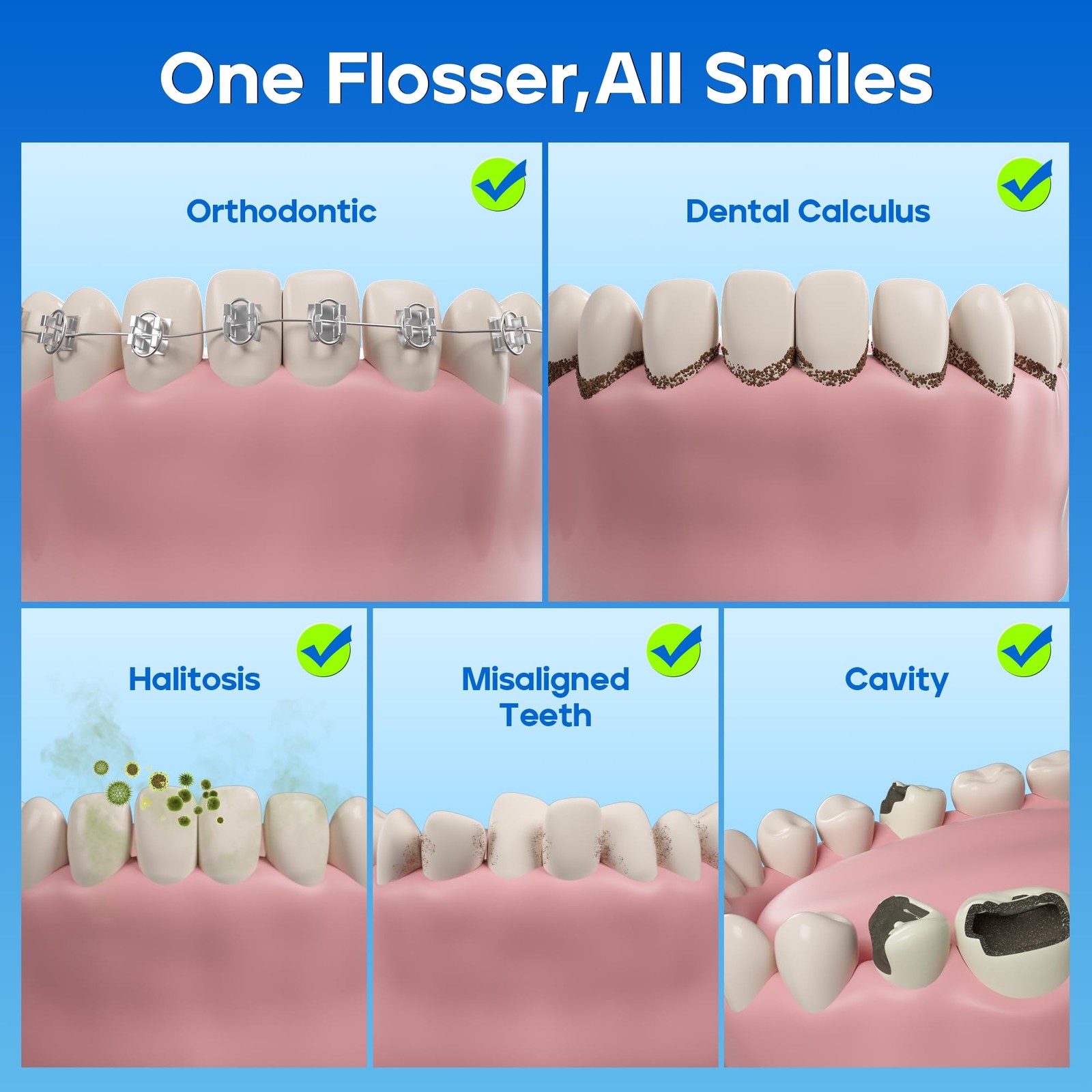 Nicwell Water Dental Flosser for Teeth – 4 Modes & 1 Count (Pack of 1), Black